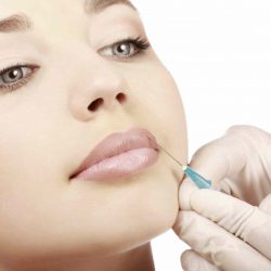 Justiça proíbe dentistas de aplicar botox em pacientes