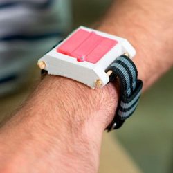 Estudantes criam “relógio-seringa” que pode salvar pessoas alérgicas