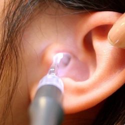 Pesquisa da UFG aponta que cera do ouvido ajuda no diagnóstico precoce do câncer