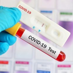 Anvisa autoriza primeiro autoteste de Covid-19 com uso de saliva