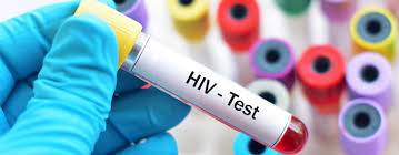HIV