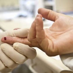 Suspensos pelo SUS, exames para HIV e hepatite já haviam caído pela metade durante pandemia