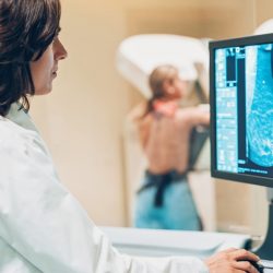 Mamografia preventiva teve uma redução de quase 70% durante a pandemia