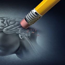 Tecnologia permite entregar remédios no cérebro de pacientes com Alzheimer
