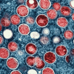 Caxias do Sul confirma caso de varíola dos macacos