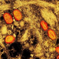 Vírus da varíola dos macacos sobrevive em superfícies por ao menos 30 dias