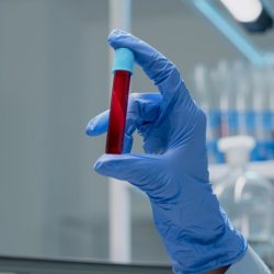 Cientistas conseguem rejuvenescer sangue com anti-inflamatório