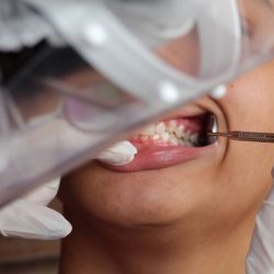 Sancionada lei que torna atendimento odontológico obrigatório no SUS