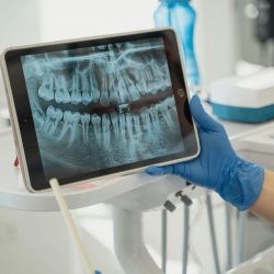 Medicamento para fazer crescer dentes será testado em humanos pela 1ª vez