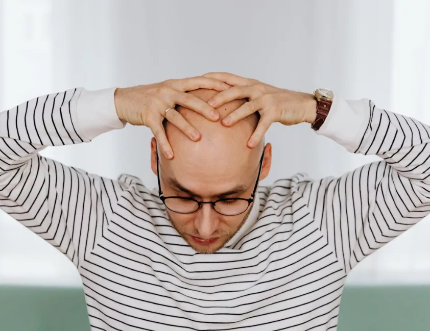 Cebolas frescas e suco natural usados em estudo sobre alopecia e crescimento capilar